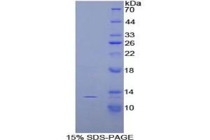 SDS-PAGE analysis of Rat Slit Homolog 3 Protein. (SLIT3 Protein)