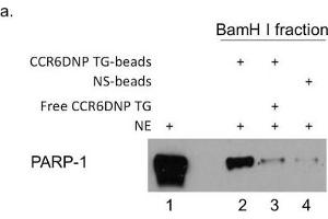 Western Blotting (WB) image for anti-Poly (ADP-Ribose) Polymerase 1 (PARP1) antibody (ABIN2854798)