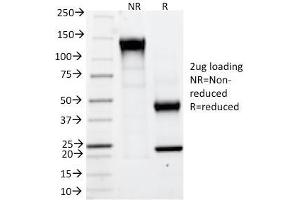 SDS-PAGE Analysis Purified CAIX Mouse Monoclonal Antibody (CA9/781). (CA9 antibody)