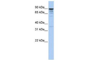 MCTP1 antibody used at 1 ug/ml to detect target protein. (MCTP1 antibody  (Middle Region))