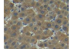 Detection of MMP7 in Human Liver Tissue using Polyclonal Antibody to Matrix Metalloproteinase 7 (MMP7)