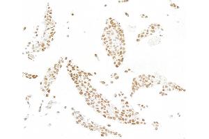 Immunocytochemistry (ICC) image for anti-SWI/SNF Related, Matrix Associated, Actin Dependent Regulator of Chromatin, Subfamily E, Member 1 (SMARCE1) (C-Term) antibody (ABIN7795730)