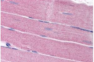 Human Skeletal Muscle (formalin-fixed, paraffin-embedded) stained with SORBS1 antibody ABIN297694 at 2. (SORBS1 antibody  (AA 1282-1294))