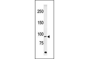 ABL1 antibody  (pTyr251)