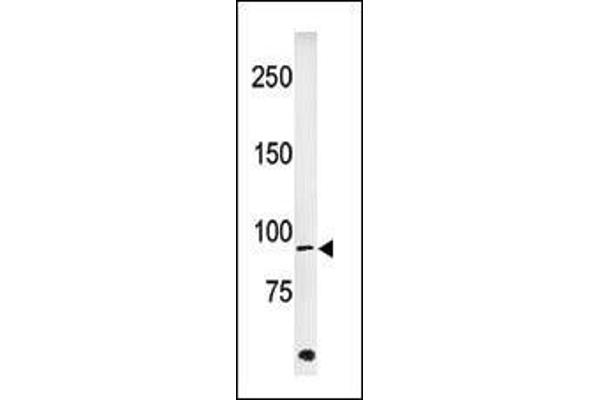 ABL1 antibody  (pTyr251)