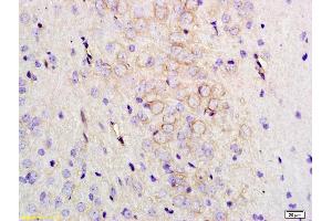 Formalin-fixed and paraffin embedded rat brain labeled with Anti-MMC3 Receptor/MC3-R Polyclonal Antibody, Unconjugated (ABIN872967) at 1:200 followed by conjugation to the secondary antibody and DAB staining.