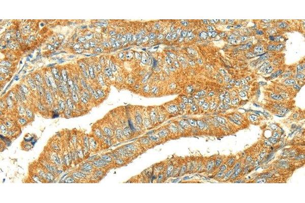 Glycerol Kinase antibody