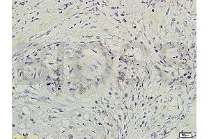 Formalin-fixed and paraffin-embedded rat brain labeled with Rabbit Anti-GRB2/ASH Polyclonal Antibody (ABIN686932) , Unconjugated 1:200 followed by conjugation to the secondary antibody and DAB staining