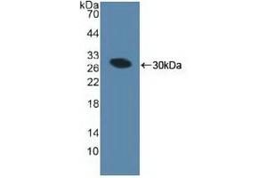 Detection of Recombinant MIB1, Human using Polyclonal Antibody to Mindbomb Homolog 1 (MIB1)