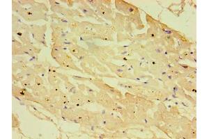 Immunohistochemistry of paraffin-embedded human heart tissue using ABIN7161936 at dilution of 1:100 (NXF3 antibody  (AA 1-531))