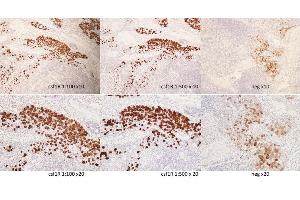 Staining of canine lymph node tissue with bs-3077r. (CSF1R antibody  (pTyr723))
