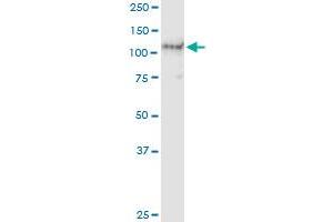 Immunoprecipitation of AXL transfected lysate using anti-AXL MaxPab rabbit polyclonal antibody and Protein A Magnetic Bead , and immunoblotted with AXL purified MaxPab mouse polyclonal antibody (B01P) . (AXL antibody  (AA 1-894))
