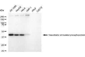 Western blotting analysis using Vasodilator stimulated phosphoprotein antibody (ABIN7800824). (Recombinant VASP antibody)
