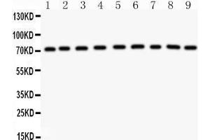 Anti-GHR antibody, Western blotting All lanes: Anti GHR  at 0. (Growth Hormone Receptor antibody  (Middle Region))