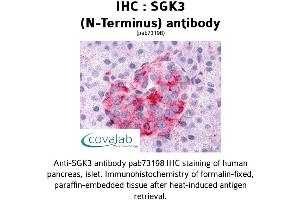 Image no. 1 for anti-serum/glucocorticoid Regulated Kinase Family, Member 3 (SGK3) (N-Term) antibody (ABIN1739228) (SGK3 antibody  (N-Term))