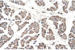Human Muscle (GCDH antibody  (C-Term))