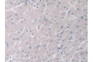 IHC-P analysis of Human Liver Tissue, with DAB staining. (MAPK12 antibody  (AA 27-311))