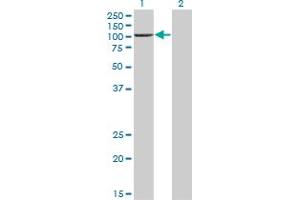 Western Blotting (WB) image for anti-K(lysine) Acetyltransferase 2B (KAT2B) (AA 353-452) antibody (ABIN522304)