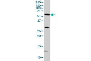 STK4 monoclonal antibody (M02), clone 4F4 Western Blot analysis of STK4 expression in HeLa . (STK4 antibody  (AA 391-485))