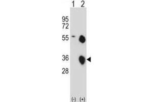 Western Blotting (WB) image for anti-Kallikrein 8 (KLK8) antibody (ABIN2997958) (Kallikrein 8 antibody)