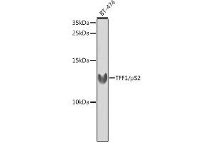 Western blot analysis of extracts of BT-474 cells, using TFF1/pS2 antibody (ABIN3015565, ABIN3015566, ABIN3015567 and ABIN6218896) at 1:1000 dilution. (TFF1 antibody  (pSer2))