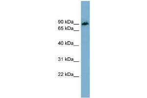 WB Suggested Anti-APBB1IP  Antibody Titration: 0. (Amyloid beta (A4) Precursor Protein-Binding, Family B, Member 1 Interacting Protein (APBB1IP) (N-Term) antibody)