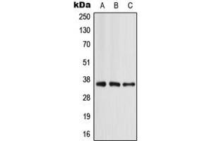 Western blot analysis of Apolipoprotein E expression in MCF7 (A), mouse liver (B), rat liver (C) whole cell lysates. (APOE antibody  (Center))