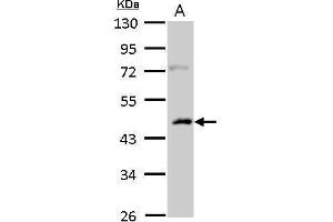 WB Image Casein Kinase 1 alpha 1L antibody detects CSNK1A1L protein by Western blot analysis.