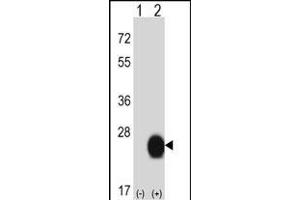 Western blot analysis of CSRP2 (arrow) using rabbit polyclonal CSRP2 Antibody (Center) (ABIN657989 and ABIN2846936). (CSRP2 antibody  (AA 68-96))