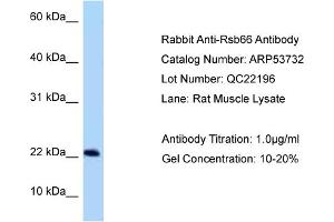 Western Blotting (WB) image for anti-Rsb-66 Protein (RSB66) (N-Term) antibody (ABIN2785546)