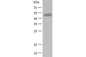 HGD Protein (AA 1-445) (His tag)
