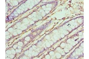 Immunohistochemistry of paraffin-embedded human colon tissue using ABIN7171965 at dilution of 1:100 (TAB1 antibody  (AA 205-504))