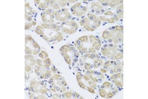 Immunohistochemistry of paraffin-embedded human stomach using DISC1 antibody at dilution of 1:100 (x40 lens).