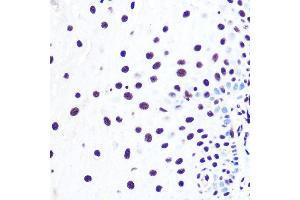 Immunohistochemistry (IHC) image for anti-RD RNA Binding Protein (RDBP) (AA 1-280) antibody (ABIN6144526)
