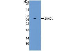 Detection of Recombinant LAG3, Mouse using Polyclonal Antibody to Lymphocyte Activation Gene 3 (LAG3) (LAG3 antibody  (AA 274-504))