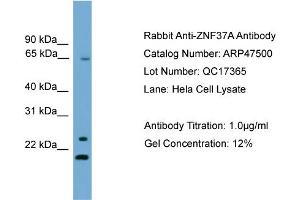 WB Suggested Anti-ZNF37A  Antibody Titration: 0. (ZNF37A antibody  (Middle Region))