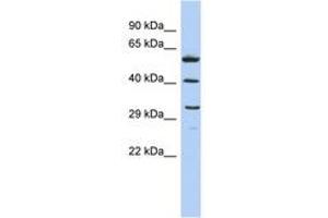 Image no. 1 for anti-C1q and Tumor Necrosis Factor Related Protein 7 (C1QTNF7) (AA 143-192) antibody (ABIN6743642) (CTRP7 antibody  (AA 143-192))