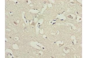 Immunohistochemistry of paraffin-embedded human brain tissue using ABIN7143514 at dilution of 1:100 (ARL6IP1 antibody  (AA 93-133))