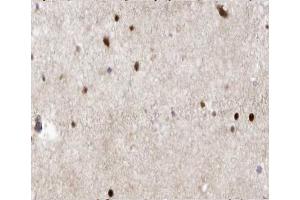 ABIN6266543 at 1/100 staining human brain tissue sections by IHC-P. (GAD antibody  (C-Term))
