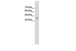 Image no. 2 for anti-serpin Peptidase Inhibitor, Clade B (Ovalbumin), Member 5 (SERPINB5) (AA 151-200) antibody (ABIN203504) (SERPINB5 antibody  (AA 151-200))