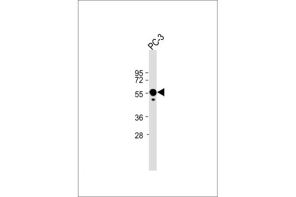 Calreticulin antibody  (AA 277-305)