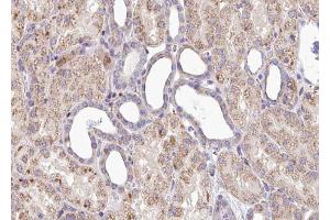 ABIN6267539 at 1/100 staining human Kidney tissue sections by IHC-P. (SOX9 antibody  (pSer181))