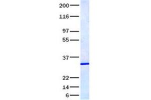 Validation with Western Blot (IL17F Protein)