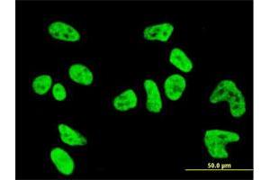 Immunofluorescence (IF) image for anti-Protein Kinase N1 (PKN1) (AA 462-615) antibody (ABIN562393)