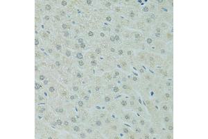 Immunohistochemistry of paraffin-embedded mouse liver using RCC1 antibody (ABIN5973761) at dilution of 1/100 (40x lens). (RCC1 antibody)