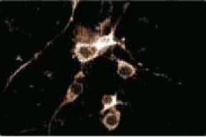 Immunofluorescence staining of rat cortical neurons. (COMT antibody  (AA 26-141))