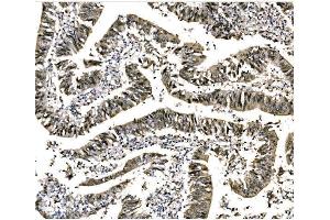 IHC analysis of EHMT2/G9A using anti-EHMT2/G9A antibody (ABIN7602084).
