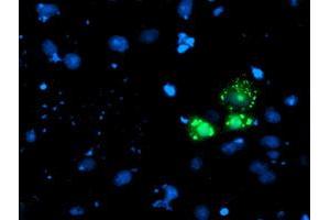 Anti-AP2M1 mouse monoclonal antibody (ABIN2454659) immunofluorescent staining of COS7 cells transiently transfected by pCMV6-ENTRY AP2M1 (RC201377). (AP2M1 antibody  (AA 97-383))