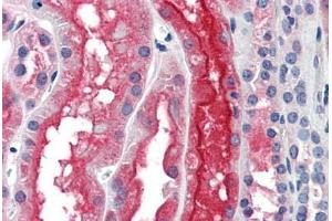 Human Kidney: Formalin-Fixed, Paraffin-Embedded (FFPE) (PDZK1 antibody  (AA 1-520))