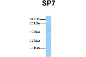 Host:  Rabbit  Target Name:  SP7  Sample Tissue:  Human Fetal Lung  Antibody Dilution:  1. (SP7 antibody  (N-Term))
